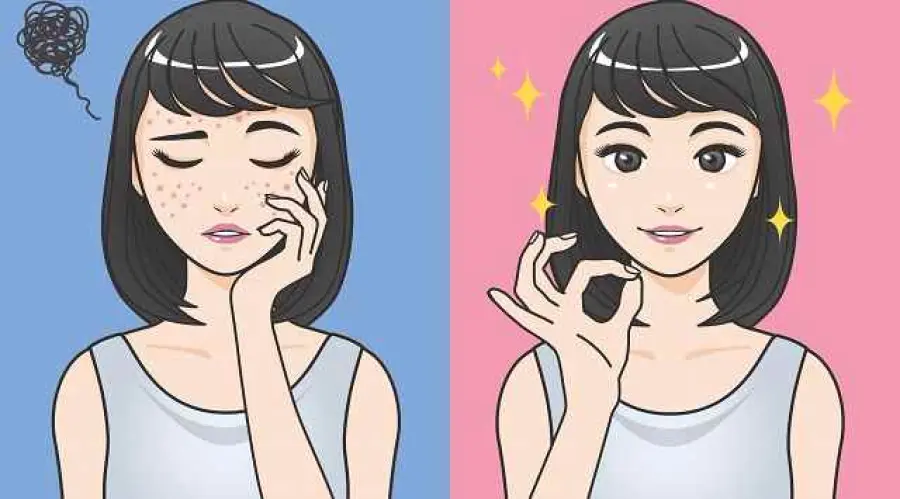 Come combattere l'acne con 5 frullati disintossicanti