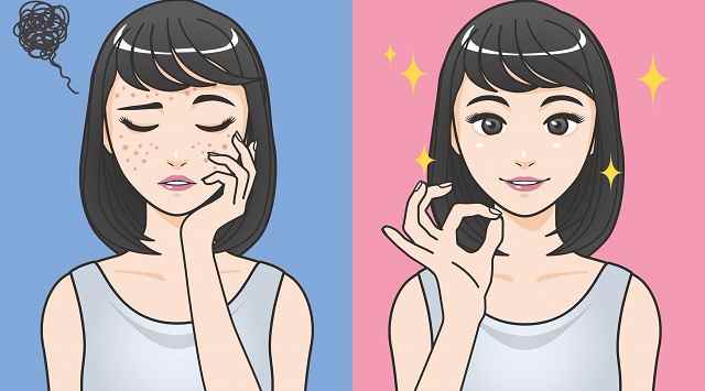 Come combattere l'acne con 5 frullati disintossicanti