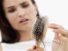 Alopecia, ecco 5 rimedi naturali
